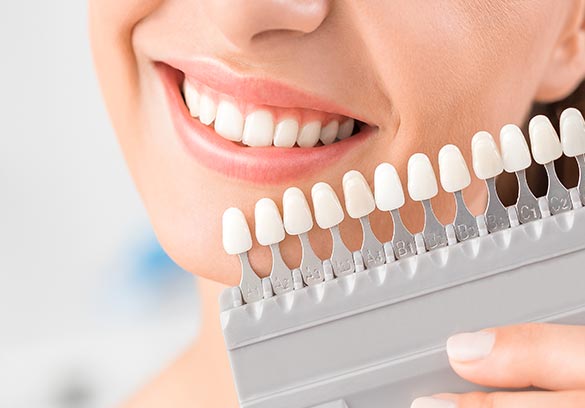 Cosmetic Dentistry