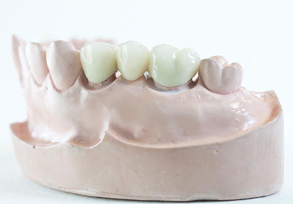 Restorative Dentistry